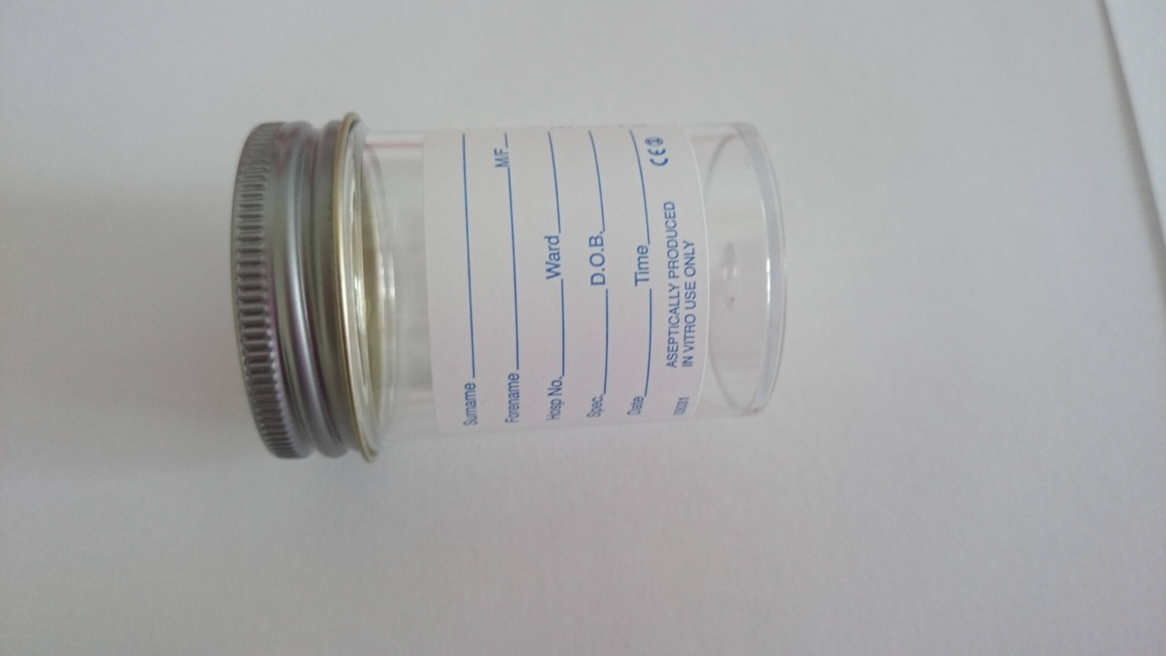 sputum culture not tb microbiology exeter clinical laboratory sputum test