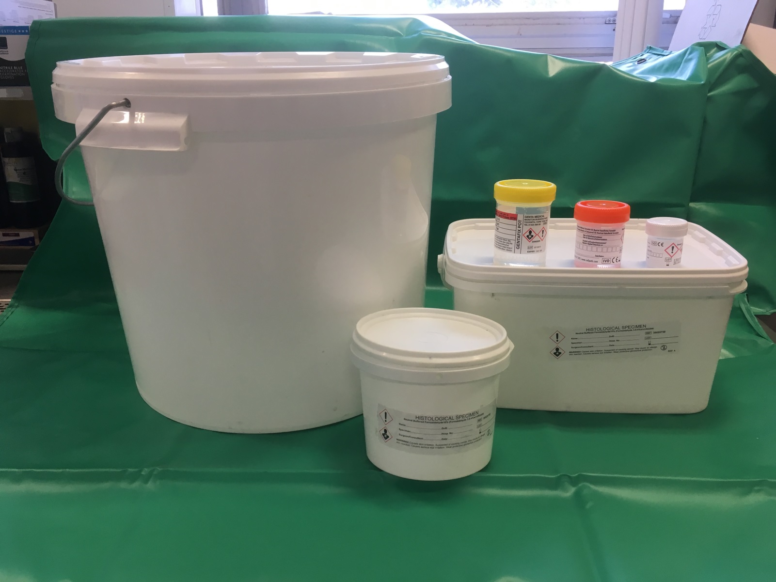 Formalin filled specimen containers / Cellular Pathology / Exeter